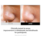 98% Reduction in Pore Impurities & 92% Less Sebum – Improves Blackheads & Whiteheads by 36% – Soothes & Strengthens Skin Barrier with D-Panthenol – Korean Skincare Best Cleansing Foam