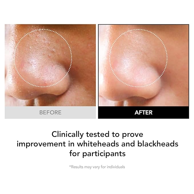 98% Reduction in Pore Impurities & 92% Less Sebum – Improves Blackheads & Whiteheads by 36% – Soothes & Strengthens Skin Barrier with D-Panthenol – Korean Skincare Best Cleansing Foam