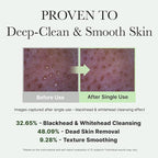 Korean Rice Mochi Face Cleanser - Face Wash, Gentle Scrub All in One for Deep Cleansing, Moisturizing, Pore Minimizing, Acne-Prone Skin, Removing Blackhead with Rice Water & Green Tea