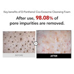 98% Reduction in Pore Impurities & 92% Less Sebum – Improves Blackheads & Whiteheads by 36% – Soothes & Strengthens Skin Barrier with D-Panthenol – Korean Skincare Best Cleansing Foam