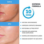 Name Skin Care Korean Carboxy CO2 Therapy Face & Neck Mask Set of 2 - Hydrating Oxygen Carboxytherapy Skincare Sheet Masks - Moisturizing Anti Aging Pore Tightening Brightening Facial Treatment Gel