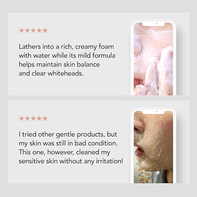 98% Reduction in Pore Impurities & 92% Less Sebum – Improves Blackheads & Whiteheads by 36% – Soothes & Strengthens Skin Barrier with D-Panthenol – Korean Skincare Best Cleansing Foam