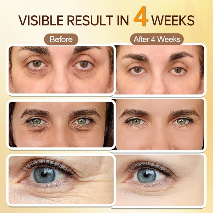 5% Caffeine Eye Serum Roller, Eye Cream for Dark Circles, Wrinkles & Puffy Eyes - with Retinal Hyaluronic Acid Peptides, Instant Depuffing Gel Eyelid Lift, 0.51 fl oz