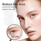 Novoy 15 Pairs Bio-Collagen Real Deep Eye Patches - 6-in-1 Retinol Overnight Eye Patches for Dark Circles, Puffiness & Wrinkles | 2% Caffeine+Hyaluronic+Niacinamide, Korean Popular Eye Mask - ROSE