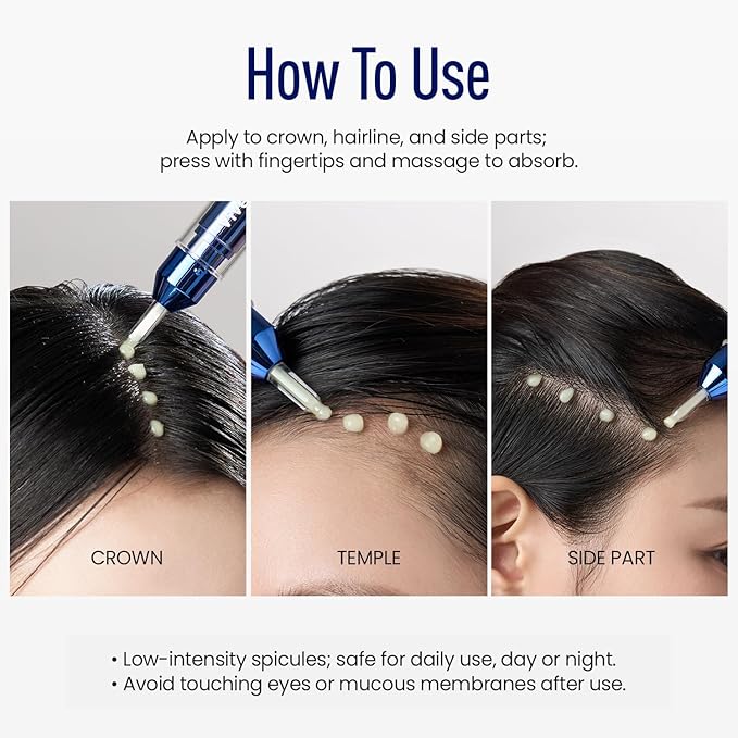 Scalp Microneedle Serum – K-beauty Hair Growth & Scalp Treatment with Spioxyl™ 400 | Fills Hair Part Line, Strengthens Roots, Reduces Hair Thinning – 220,000 Microneedle Formula