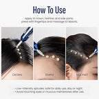 Scalp Microneedle Serum – K-beauty Hair Growth & Scalp Treatment with Spioxyl™ 400 | Fills Hair Part Line, Strengthens Roots, Reduces Hair Thinning – 220,000 Microneedle Formula