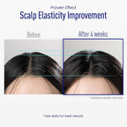 Scalp Microneedle Serum – K-beauty Hair Growth & Scalp Treatment with Spioxyl™ 400 | Fills Hair Part Line, Strengthens Roots, Reduces Hair Thinning – 220,000 Microneedle Formula