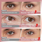 Novoy 15 Pairs Bio-Collagen Real Deep Eye Patches - 6-in-1 Retinol Overnight Eye Patches for Dark Circles, Puffiness & Wrinkles | 2% Caffeine+Hyaluronic+Niacinamide, Korean Popular Eye Mask - ROSE