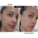 Kate Somerville EradiKate 3% Sulfur Daily Foaming Cleanser Acne Treatment – Clinically Formulated Medicated Face Wash Balances Skin & Cleans Pores, 4 Fl Oz